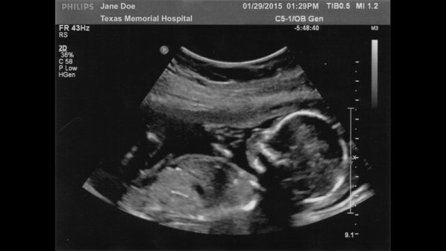 fake baby ultrasound free